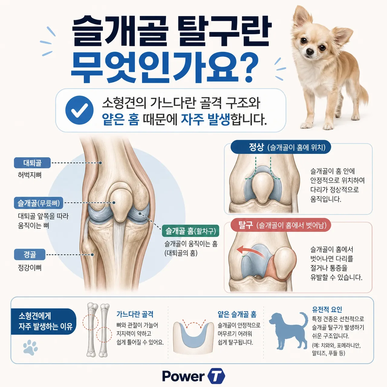 슬개골 탈구란 무었인지 설명
